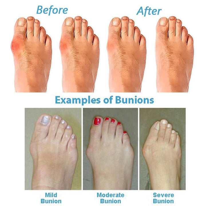 Suki | Women's Orthopedic Cushioned Sandals for Walking